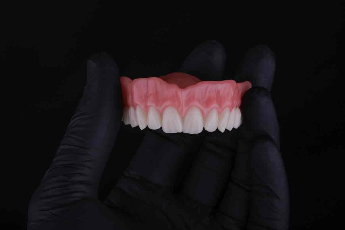 Jacks-Denture1 Jacks-Denture1